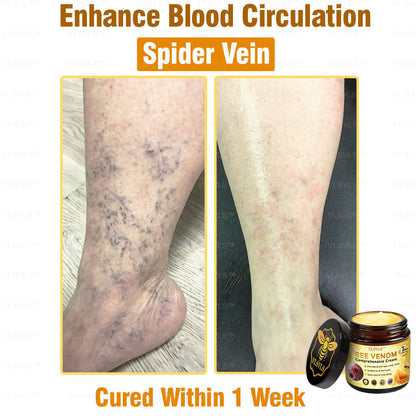 VLSVLS™ Bee Venom Comprehensive Cream 🎉🎉(Suitable for all ages & TGA recommends)
