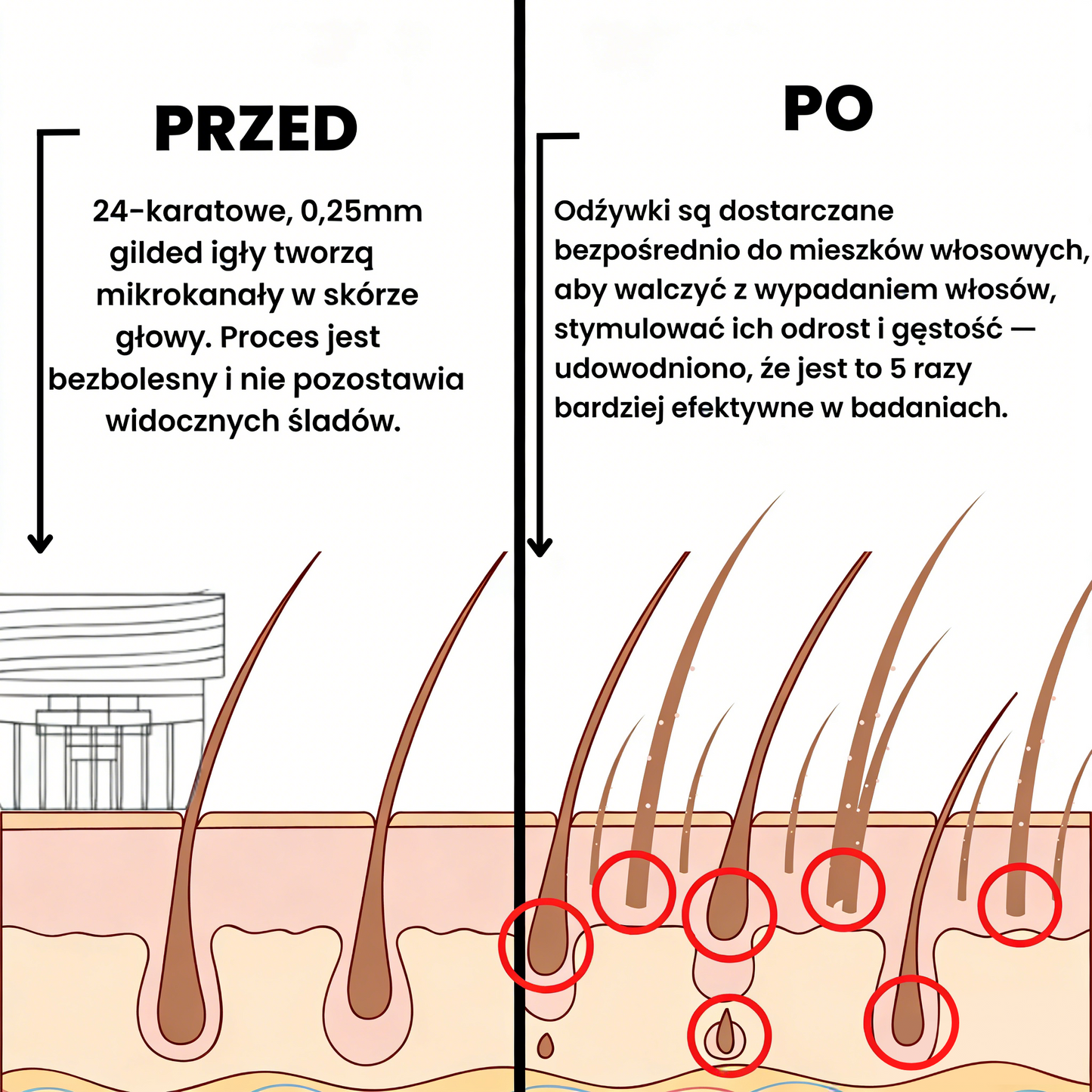 [Oferta specjalna noworoczna] System odrastania włosów Hudros®👩‍⚕️Przywróć swoim włosom idealny wygląd