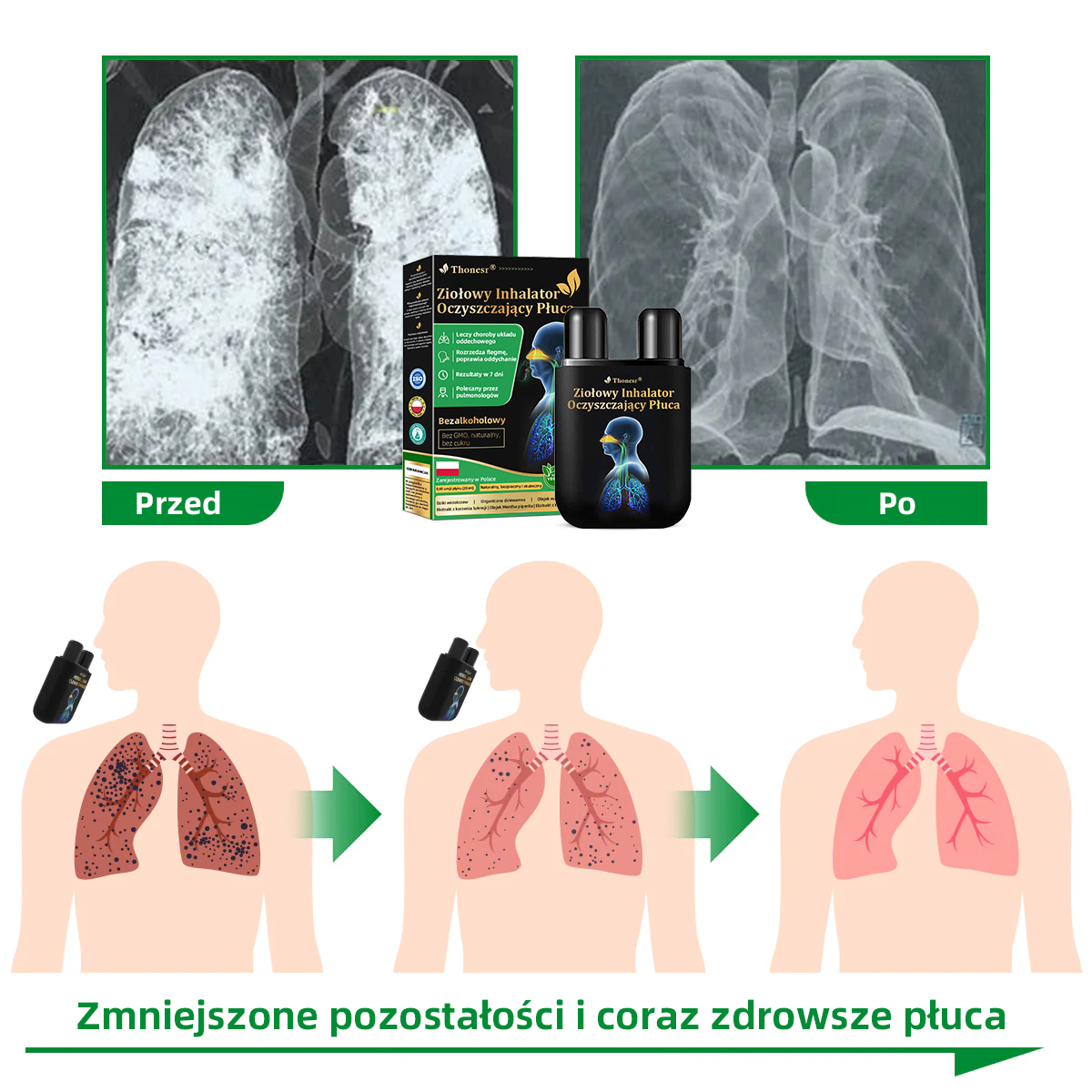 Oficjalny sklep💝✅:Thonesr® Ziołowy Inhalator Oczyszczający Płuca  🫁Zatwierdzony przez URPL(💝 kaszel, świszczący oddech, duszność, plwocina, zatkany nos, zapalenie oskrzeli, zapalenie oskrzeli, objawy alergii, dyskomfort w płucach💝)👩‍⚕️