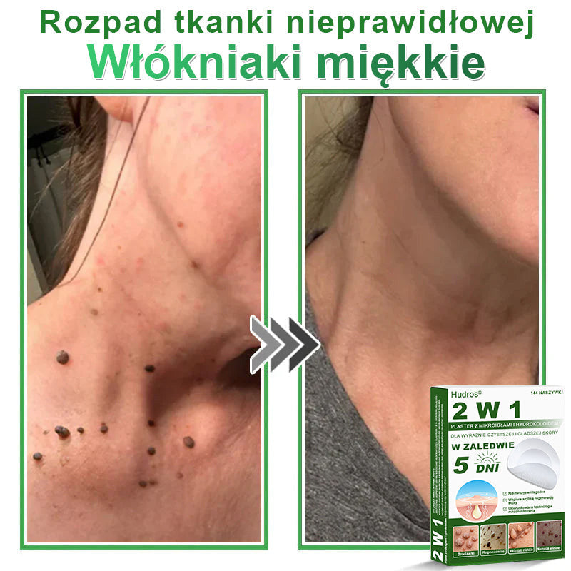 𝐇𝐮𝐝𝐫𝐨𝐬® 📌 𝐇𝐲𝐝𝐫𝐨ż𝐞𝐥𝐨𝐰𝐞 𝐩𝐥𝐚𝐬𝐭𝐫𝐲 𝐳 𝐦𝐢𝐤𝐫𝐨𝐢𝐠ł𝐚𝐦𝐢 𝟐 𝐰 𝟏 | 𝐒𝐩𝐞𝐜𝐣𝐚𝐥𝐧𝐢𝐞 𝐨𝐩𝐫𝐚𝐜𝐨𝐰𝐚𝐧𝐞 𝐝𝐨 𝐮𝐬𝐮𝐰𝐚𝐧𝐢𝐚 𝐰𝐲𝐩𝐮𝐤ł𝐲𝐜𝐡 𝐳𝐧𝐚𝐦𝐢𝐨𝐧, 𝐭𝐫ą𝐝𝐳𝐢𝐤𝐮, 𝐩ł𝐚𝐬𝐤𝐢𝐜𝐡 𝐛𝐫𝐨𝐝𝐚𝐰𝐞𝐤 𝐢 𝐳𝐦𝐢𝐚𝐧 𝐬𝐤ó𝐫𝐧𝐲𝐜𝐡 | 𝐎𝐩𝐚𝐤𝐨𝐰𝐚𝐧𝐢𝐞 𝟏𝟒𝟒 𝐬𝐳𝐭𝐮𝐤☘️☘️