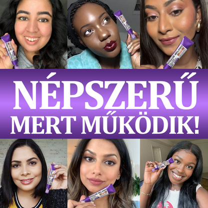 🩷✅ EMMI minősítés| Ropceer® 𝐄𝐏𝐈𝐆𝐋𝐎𝐖 𝐌𝐞𝐥𝐚𝐧𝐄𝐗 Prémium arckrém