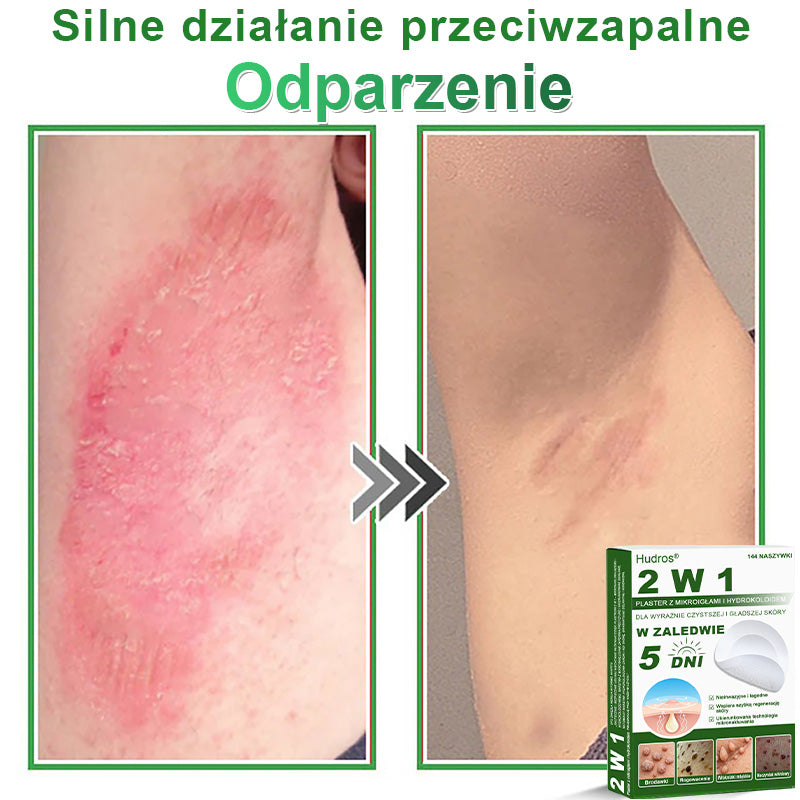 𝐇𝐮𝐝𝐫𝐨𝐬® 📌 𝐇𝐲𝐝𝐫𝐨ż𝐞𝐥𝐨𝐰𝐞 𝐩𝐥𝐚𝐬𝐭𝐫𝐲 𝐳 𝐦𝐢𝐤𝐫𝐨𝐢𝐠ł𝐚𝐦𝐢 𝟐 𝐰 𝟏 | 𝐒𝐩𝐞𝐜𝐣𝐚𝐥𝐧𝐢𝐞 𝐨𝐩𝐫𝐚𝐜𝐨𝐰𝐚𝐧𝐞 𝐝𝐨 𝐮𝐬𝐮𝐰𝐚𝐧𝐢𝐚 𝐰𝐲𝐩𝐮𝐤ł𝐲𝐜𝐡 𝐳𝐧𝐚𝐦𝐢𝐨𝐧, 𝐭𝐫ą𝐝𝐳𝐢𝐤𝐮, 𝐩ł𝐚𝐬𝐤𝐢𝐜𝐡 𝐛𝐫𝐨𝐝𝐚𝐰𝐞𝐤 𝐢 𝐳𝐦𝐢𝐚𝐧 𝐬𝐤ó𝐫𝐧𝐲𝐜𝐡 | 𝐎𝐩𝐚𝐤𝐨𝐰𝐚𝐧𝐢𝐞 𝟏𝟒𝟒 𝐬𝐳𝐭𝐮𝐤☘️☘️