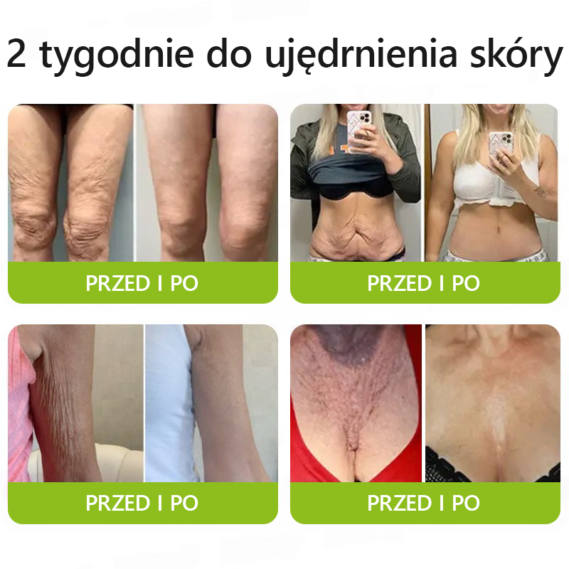 [🔥Last Day 70% OFF] Toclvo® Botox a vitamín A retinolová injekcia - Eraser for Deep Wrinkles, Sagging Jowls & Puffy Eyes