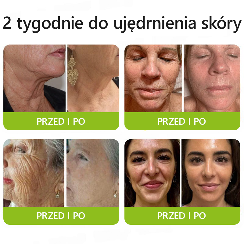 [🔥Last Day 70% OFF] Toclvo® Botox a vitamín A retinolová injekcia - Eraser for Deep Wrinkles, Sagging Jowls & Puffy Eyes