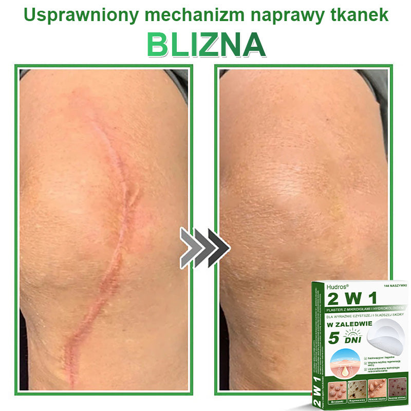 𝐇𝐮𝐝𝐫𝐨𝐬® 📌 𝐇𝐲𝐝𝐫𝐨ż𝐞𝐥𝐨𝐰𝐞 𝐩𝐥𝐚𝐬𝐭𝐫𝐲 𝐳 𝐦𝐢𝐤𝐫𝐨𝐢𝐠ł𝐚𝐦𝐢 𝟐 𝐰 𝟏 | 𝐒𝐩𝐞𝐜𝐣𝐚𝐥𝐧𝐢𝐞 𝐨𝐩𝐫𝐚𝐜𝐨𝐰𝐚𝐧𝐞 𝐝𝐨 𝐮𝐬𝐮𝐰𝐚𝐧𝐢𝐚 𝐰𝐲𝐩𝐮𝐤ł𝐲𝐜𝐡 𝐳𝐧𝐚𝐦𝐢𝐨𝐧, 𝐭𝐫ą𝐝𝐳𝐢𝐤𝐮, 𝐩ł𝐚𝐬𝐤𝐢𝐜𝐡 𝐛𝐫𝐨𝐝𝐚𝐰𝐞𝐤 𝐢 𝐳𝐦𝐢𝐚𝐧 𝐬𝐤ó𝐫𝐧𝐲𝐜𝐡 | 𝐎𝐩𝐚𝐤𝐨𝐰𝐚𝐧𝐢𝐞 𝟏𝟒𝟒 𝐬𝐳𝐭𝐮𝐤☘️☘️