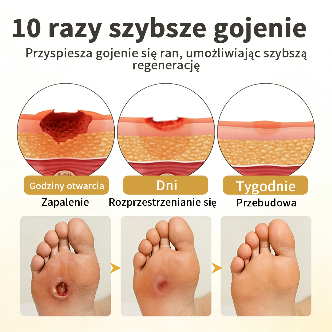 𝑯𝒖𝒅𝒓𝒐𝒔® 🧪 𝑮𝒍𝒖𝒄𝒂𝑽𝒆𝒊𝒍 24𝑯 𝒔𝒑𝒓𝒂𝒚 𝒐𝒄𝒉𝒓𝒐𝒏𝒏𝒚 𝒅𝒐 𝒔𝒕ó𝒑 ☘️