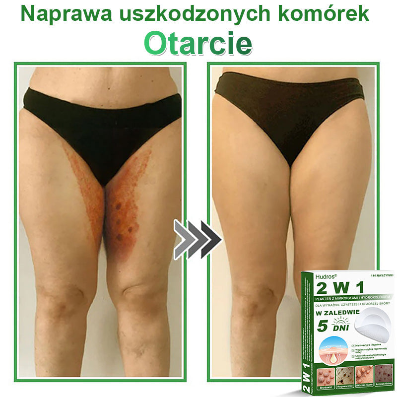 𝐇𝐮𝐝𝐫𝐨𝐬® 📌 𝐇𝐲𝐝𝐫𝐨ż𝐞𝐥𝐨𝐰𝐞 𝐩𝐥𝐚𝐬𝐭𝐫𝐲 𝐳 𝐦𝐢𝐤𝐫𝐨𝐢𝐠ł𝐚𝐦𝐢 𝟐 𝐰 𝟏 | 𝐒𝐩𝐞𝐜𝐣𝐚𝐥𝐧𝐢𝐞 𝐨𝐩𝐫𝐚𝐜𝐨𝐰𝐚𝐧𝐞 𝐝𝐨 𝐮𝐬𝐮𝐰𝐚𝐧𝐢𝐚 𝐰𝐲𝐩𝐮𝐤ł𝐲𝐜𝐡 𝐳𝐧𝐚𝐦𝐢𝐨𝐧, 𝐭𝐫ą𝐝𝐳𝐢𝐤𝐮, 𝐩ł𝐚𝐬𝐤𝐢𝐜𝐡 𝐛𝐫𝐨𝐝𝐚𝐰𝐞𝐤 𝐢 𝐳𝐦𝐢𝐚𝐧 𝐬𝐤ó𝐫𝐧𝐲𝐜𝐡 | 𝐎𝐩𝐚𝐤𝐨𝐰𝐚𝐧𝐢𝐞 𝟏𝟒𝟒 𝐬𝐳𝐭𝐮𝐤☘️☘️