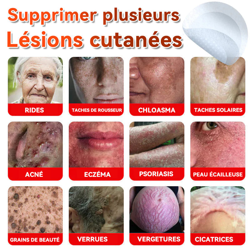 𝐅𝐀𝐓𝐎𝐍𝐆® 𝐌𝐢𝐜𝐫𝐨-𝐀𝐢𝐠𝐮𝐢𝐥𝐥𝐞 𝐁𝐨𝐭𝐚𝐧𝐢𝐪𝐮𝐞 𝐏𝐚𝐭𝐜𝐡 𝐏𝐨𝐮𝐫 É𝐥𝐢𝐦𝐢𝐧𝐞𝐫 𝐋𝐞𝐬 𝐀𝐜𝐫𝐨𝐧𝐲𝐦𝐞𝐬 𝐂𝐮𝐭𝐚𝐧é𝐬 🇺🇸 Fabriqué en France🍁💖