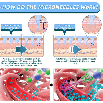 【Lmipki® Official Store】 NIDDK-Tirzepatide Nano Microneedle Patch 🇺🇸（Zero Pain, 24/7 Release | Lose 20lbs FAST | 90% Sugar Drop | ）