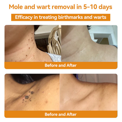 Turonu™ 𝐁𝐞𝐞 𝐕𝐞𝐧𝐨𝐦 𝐒𝐤𝐢𝐧 𝐓𝐫𝐞𝐚𝐭𝐦𝐞𝐧𝐭 𝐂𝐫𝐞𝐚𝐦🐝（CDA 𝑅𝑒𝑐𝑜𝑚𝑚𝑒𝑛𝑑𝑒𝑑） (⏰𝑳𝒂𝒔𝒕 𝒅𝒂𝒚 𝒑𝒓𝒐𝒎𝒐𝒕𝒊𝒐𝒏 80% 𝒐𝒇𝒇)